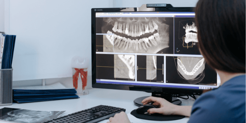 A dental radiography nurse looking at a dental radiograph on a computer