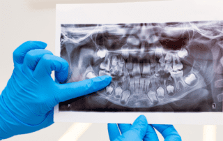 A person holding a dental radiograph